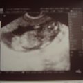 Moje Usg malenstwo ma 13 tyg.i 6 dni z dnia 5.02.2008r