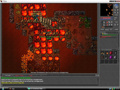 nbv #tibia